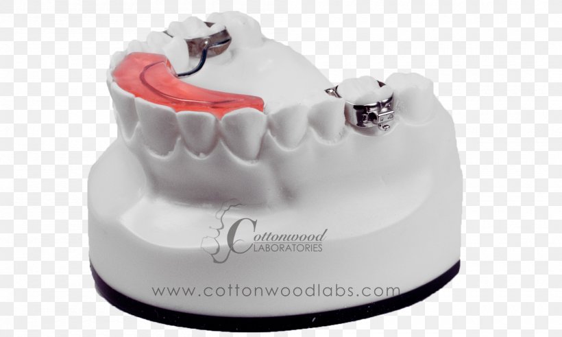 Biting Tooth Behavior Dentistry, PNG, 2000x1200px, Biting, Behavior, Cake, Chart, Dental Assistant Download Free