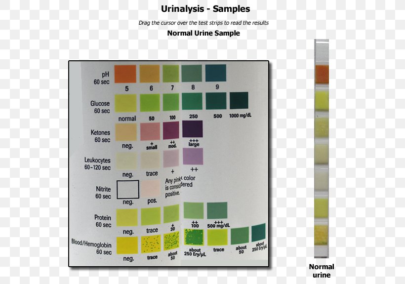 Human Anatomy & Physiology Clinical Urine Tests Urine Test Strip Ketone Bodies, PNG, 600x575px, Human Anatomy Physiology, Blood, Blood Sugar, Clinical Urine Tests, Diabetes In Cats Download Free