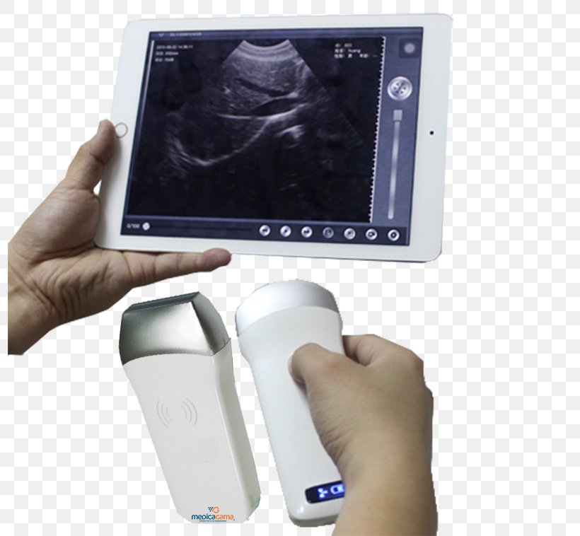 Mobile Phones Ultrasonography Ultrasound Medicine Health, PNG, 798x758px, Mobile Phones, Cause, Communication Device, Disease, Doppler Ultrasonography Download Free
