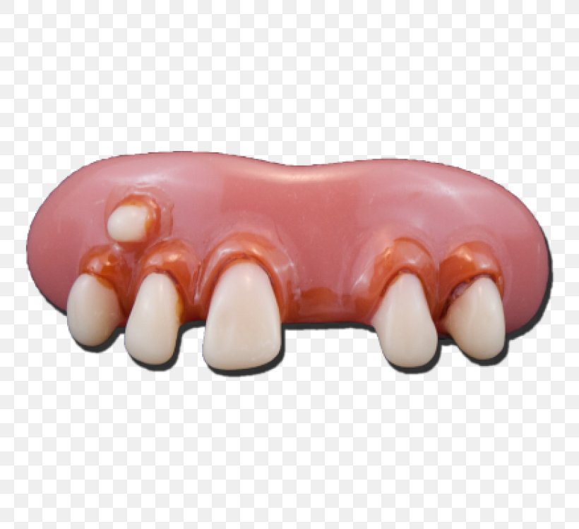 Human Tooth Dentistry Dentures, PNG, 750x750px, Tooth, Costume, Deliverance, Dental Braces, Dentist Download Free