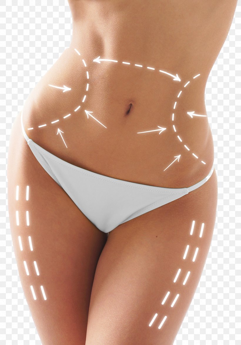 Laser Plastic Surgery Liposuction Body Contouring, PNG, 871x1251px, Watercolor, Cartoon, Flower, Frame, Heart Download Free