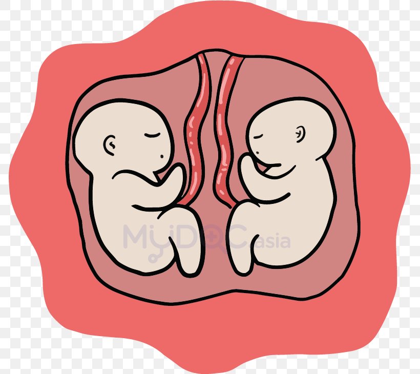 Caesarean Section Birth Mother Twin Pregnancy, PNG, 785x730px, Watercolor, Cartoon, Flower, Frame, Heart Download Free