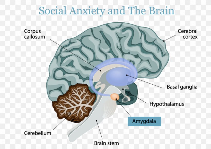 Human Brain Autism Autistic Spectrum Disorders Amygdala, PNG, 1024x724px, Watercolor, Cartoon, Flower, Frame, Heart Download Free