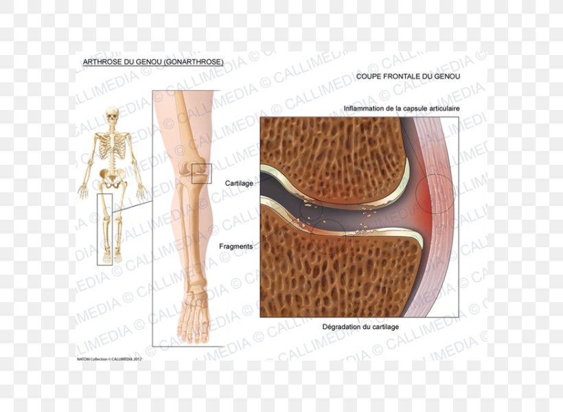 Shoulder Fibular Collateral Ligament Knee, PNG, 600x600px, Shoulder, Fibular Collateral Ligament, Joint, Knee, Ligament Download Free