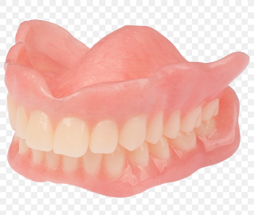 Tooth Dentures AvaDent Art Analog Signal, PNG, 800x694px, Tooth, Analog Signal, Art, Avadent, Dentures Download Free