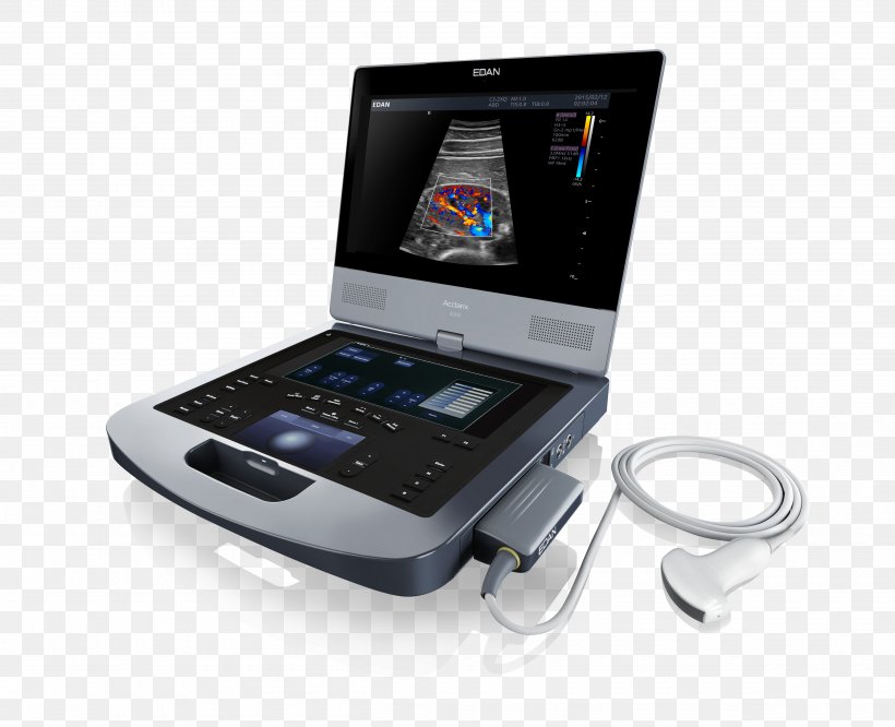 Ultrasonography Ultrasound Doppler Echocardiography Medical Diagnosis Medical Imaging, PNG, 4800x3900px, Ultrasonography, Computer Monitor Accessory, Doppler Echocardiography, Doppler Fetal Monitor, Doppler Ultrasonography Download Free