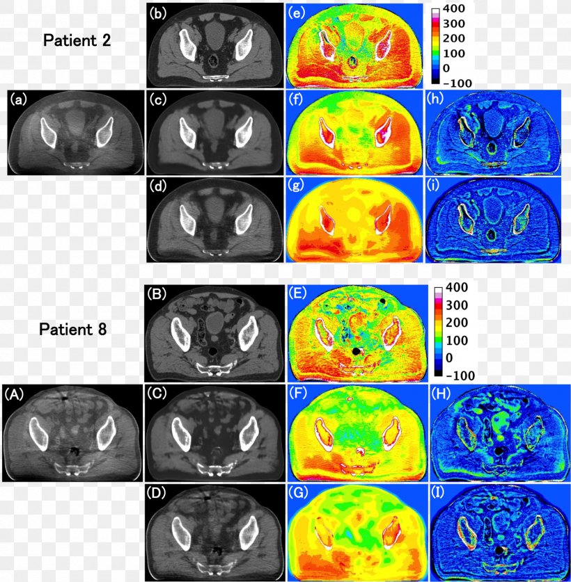 Medical Imaging Cone Beam Computed Tomography Radiology, PNG, 2000x2043px, Medical Imaging, Brain, Computed Tomography, Cone, Cone Beam Computed Tomography Download Free