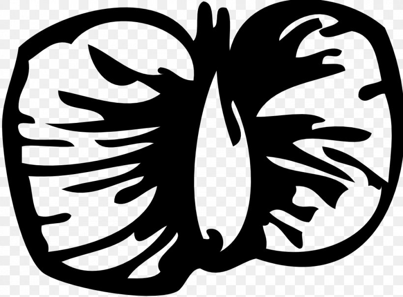 Download Clip Art, PNG, 999x737px, Birch, Artwork, Black And White, Butterfly, Flower Download Free