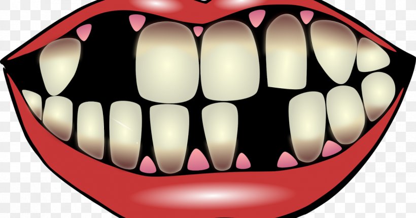 Tooth Loss Human Tooth Clip Art, PNG, 1200x630px, Watercolor, Cartoon, Flower, Frame, Heart Download Free