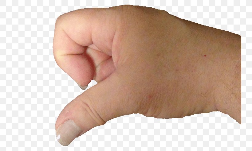 Thumb Index Finger Knuckle Joint, PNG, 750x492px, Thumb, Acoustic Guitar, Arm, Finger, Guitar Download Free