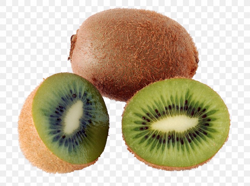 Kiwifruit Sapodilla Food Health, PNG, 1000x746px, Kiwifruit, Actinidia Deliciosa, Banana, Berry, Blackcurrant Download Free