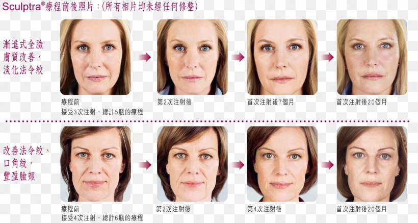 Eyebrow Cheek Nasolabial Fold Botulinum Toxin Forehead, PNG, 1962x1047px, Eyebrow, Botulinum Toxin, Cheek, Chin, Eyelash Download Free