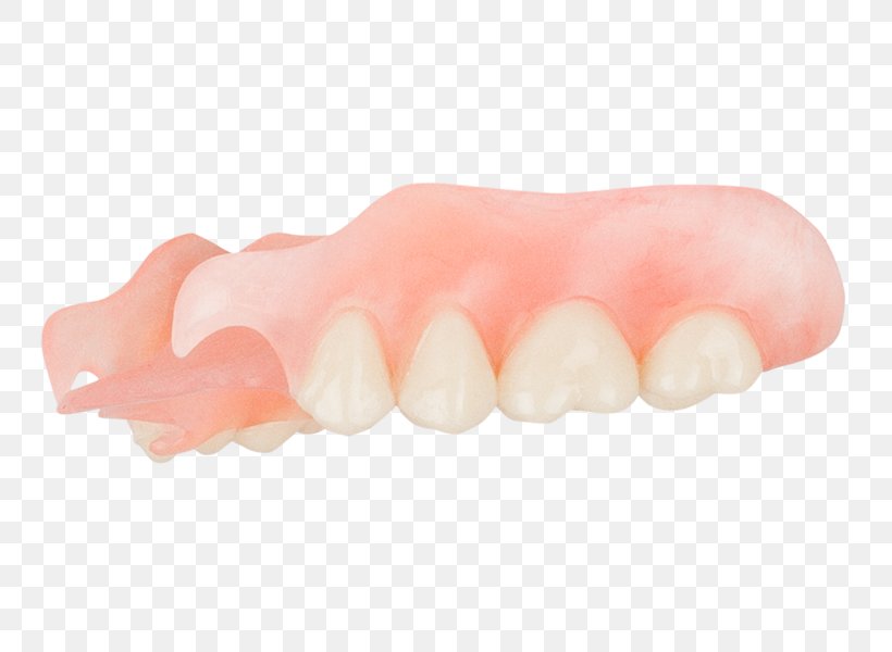 Tooth Dentures Peach, PNG, 749x600px, Tooth, Dentures, Jaw, Lip, Mouth Download Free