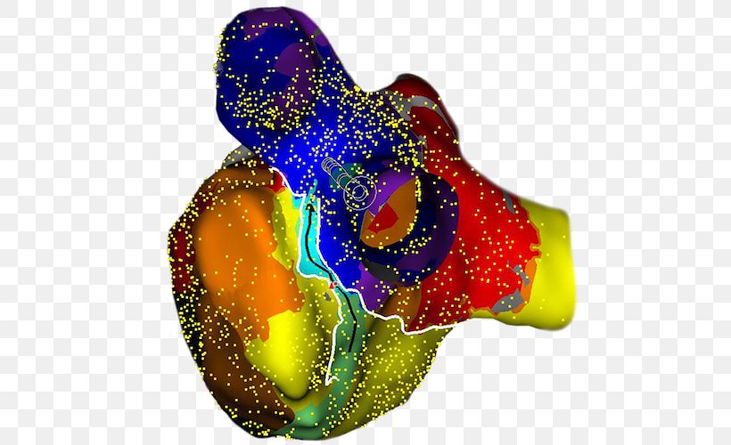 St. Jude Medical Cardiology Heart Arrhythmia Catheter, PNG, 500x500px, St Jude Medical, Ablation, Accuracy And Precision, Atrial Fibrillation, Cardiology Download Free