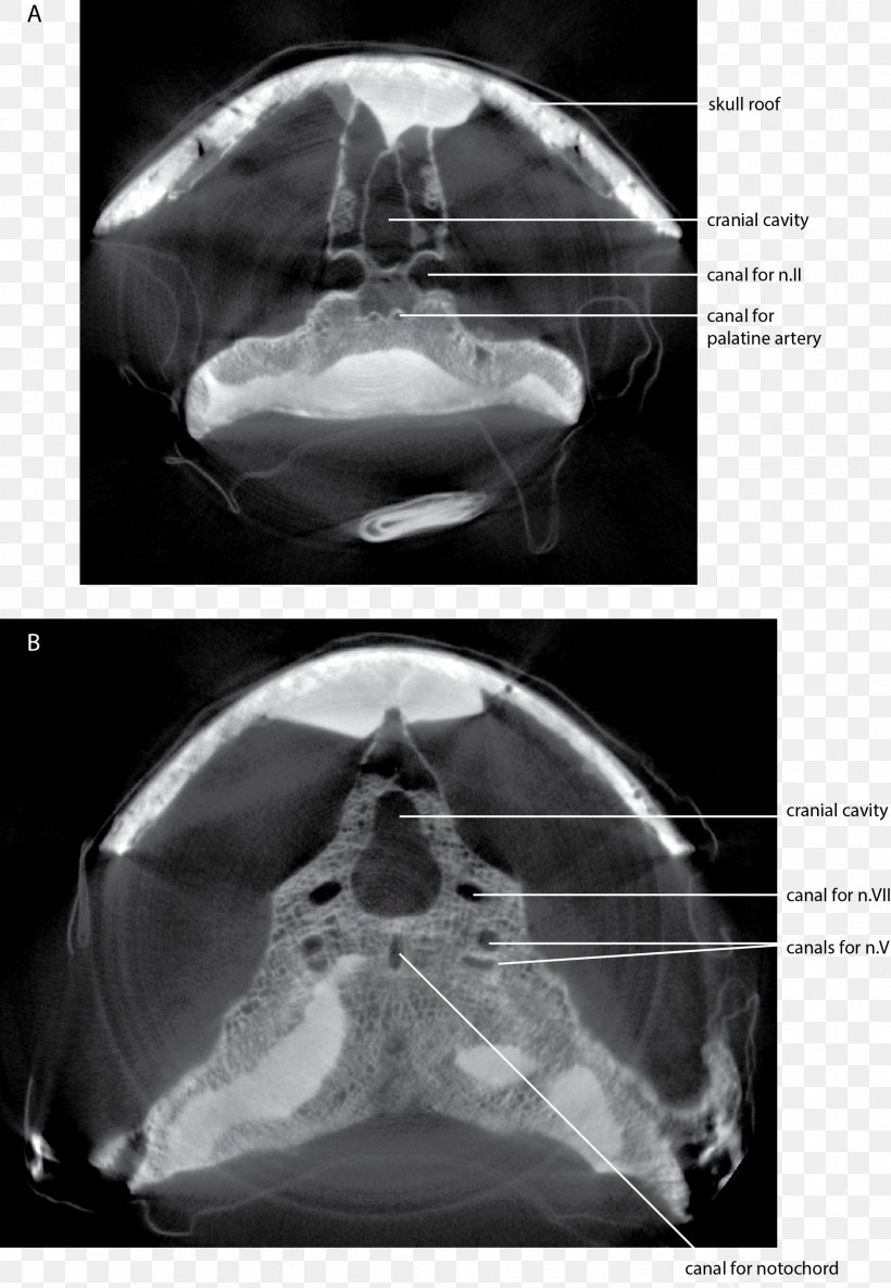 Computed Tomography Dipnorhynchus Skull Lungfish Endocast, PNG, 1785x2581px, Computed Tomography, Black And White, Devonian, Jaw, Lungfish Download Free