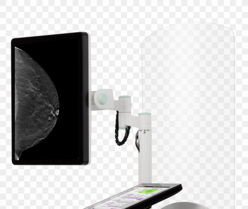 Medical Imaging Mammography Computer Monitor Accessory Ultrasonography, PNG, 830x700px, Medical Imaging, Computed Tomography, Computer Monitor Accessory, Display Resolution, Electronic Device Download Free