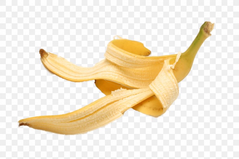 Banana Peel Banana Split Health, PNG, 1000x667px, Banana Peel, Banana, Banana Family, Banana Split, Dentist Download Free
