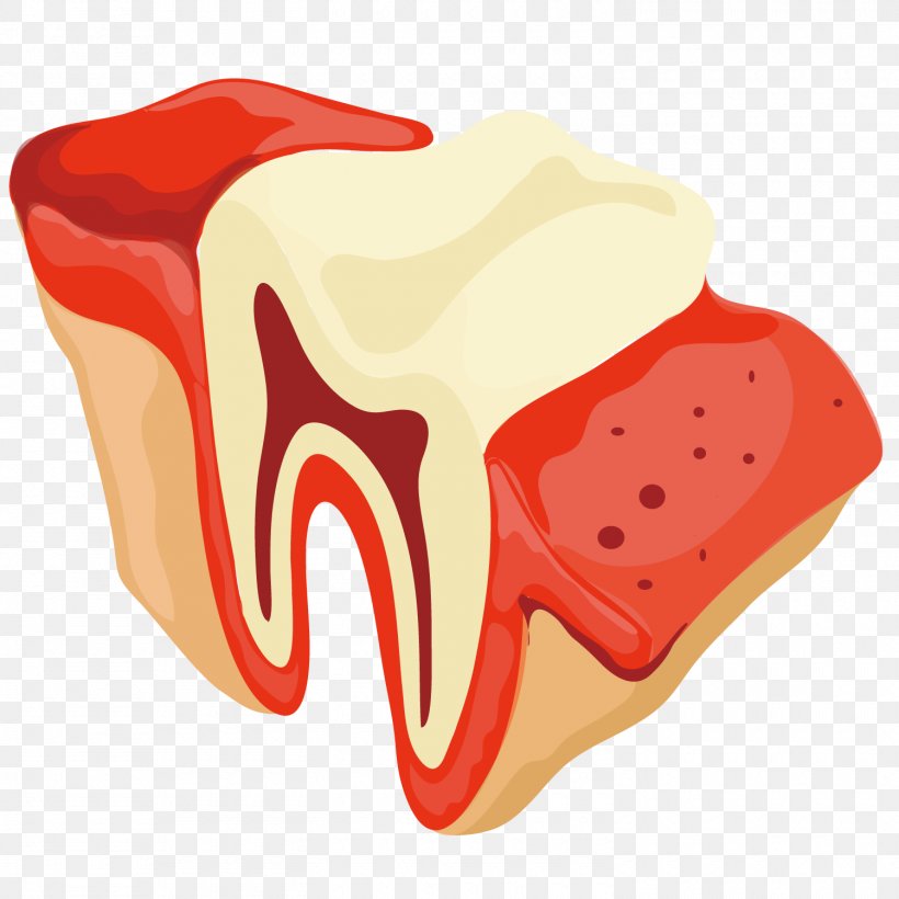Tooth Dentist Gums, PNG, 1500x1500px, Watercolor, Cartoon, Flower, Frame, Heart Download Free
