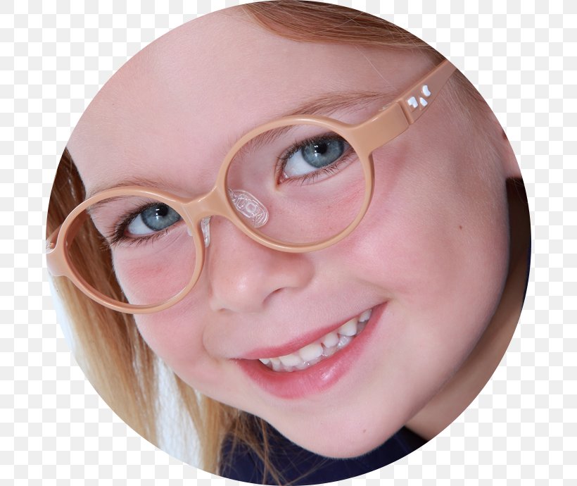 Glasses Child Infant Eyewear Visual Acuity, PNG, 690x690px, Glasses, Babywearing, Cheek, Child, Chin Download Free