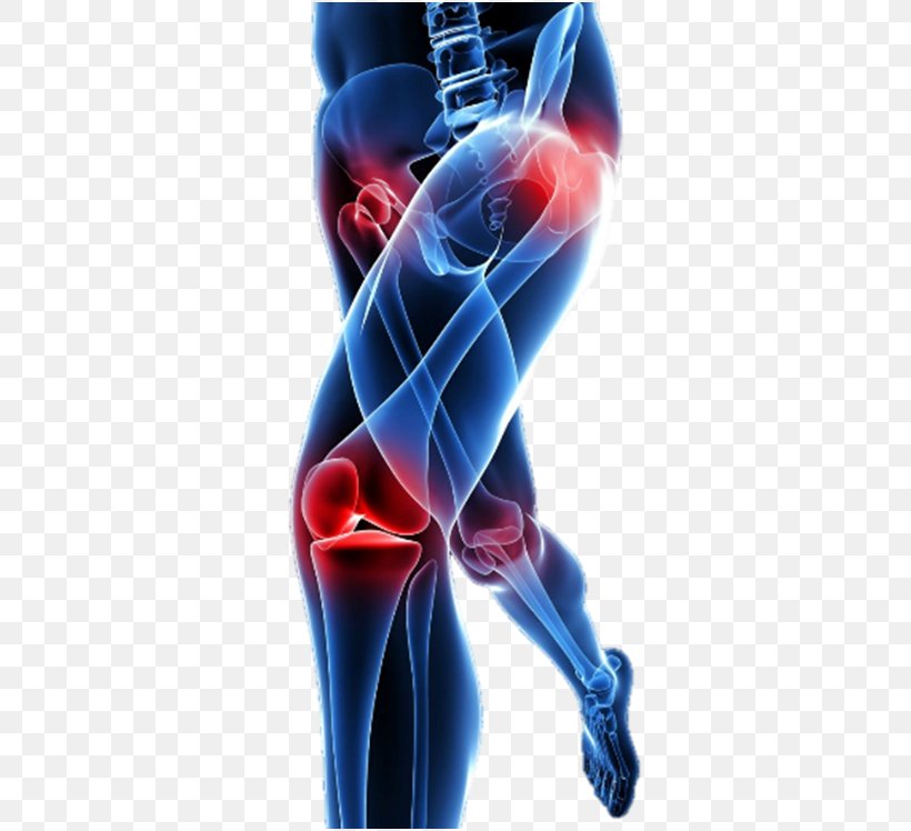 Low Back Pain Knee Pain Pain Management Neck Pain, PNG, 439x748px, Back Pain, Ache, Arthritis, Electric Blue, Hip Download Free