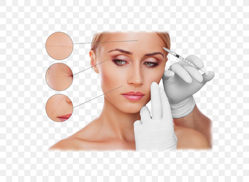 Mesotherapy Cosmetology Skin Beauty Parlour Hair, PNG, 600x600px, Mesotherapy, Beauty, Beauty Parlour, Body, Cheek Download Free