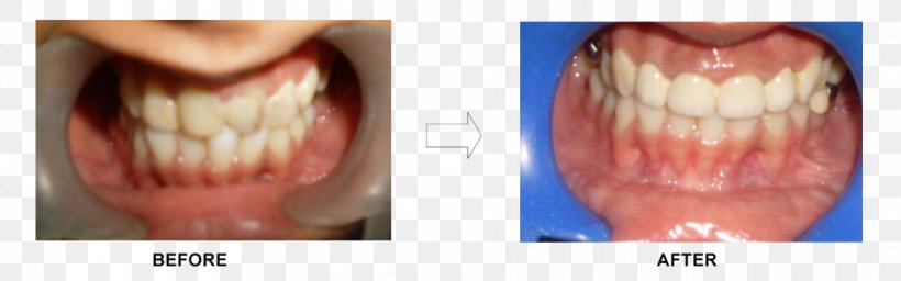 Tooth Dentistry Close-up Ceramco Dental Clinic Borivali, PNG, 960x300px, Tooth, Career, Cheek, Chin, Clinic Download Free