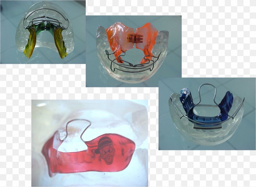 Dentist Plastic Surgeon, PNG, 1502x1102px, Dentist, Dental Technician, Glass, Goal, Maxilla Download Free