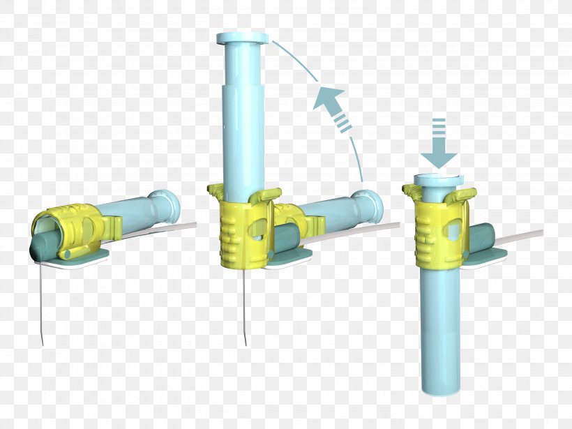 Cardiomed Supplies Inc Hypodermic Needle Catheter Needlestick Injury Patient, PNG, 2880x2160px, Cardiomed Supplies Inc, Blood, Catheter, Cylinder, Dialysis Download Free