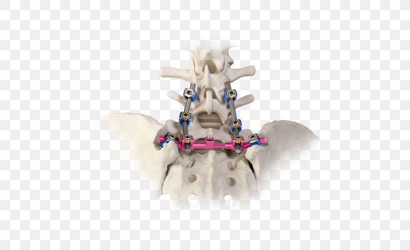 Vertebra Sacroiliac Joint Osteosynthesis Information Sacrum, PNG, 500x500px, Vertebra, Axis, Bone, Figurine, Globus Medical Inc Download Free