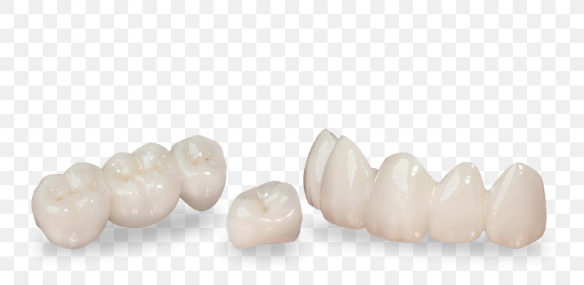 Family Dentistry Tooth Jewellery Health, PNG, 758x400px, Tooth, Body Jewellery, Body Jewelry, Ceramic, Dentistry Download Free