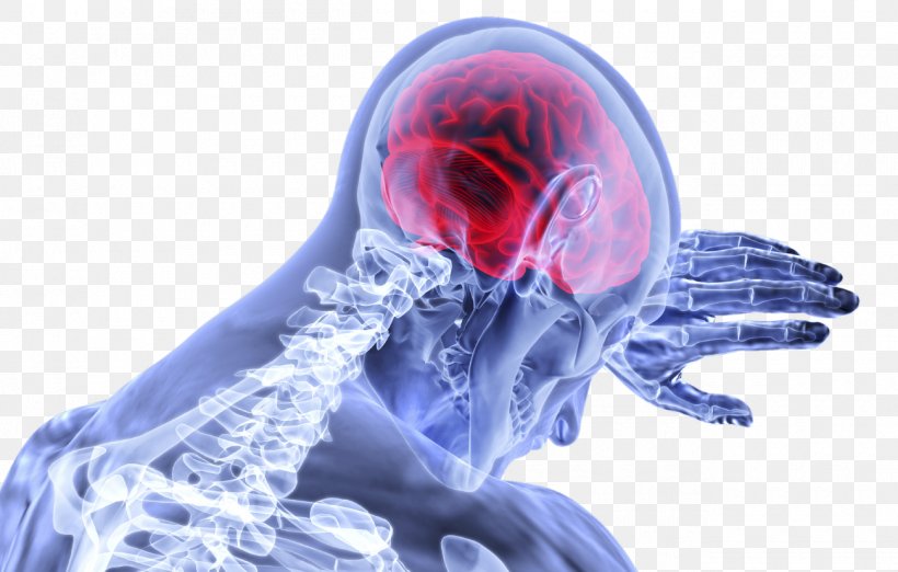 Human Brain Traumatic Brain Injury Brainstem, PNG, 1300x829px, Watercolor, Cartoon, Flower, Frame, Heart Download Free