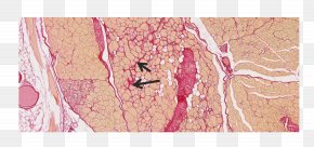 Skeletal Muscle - Blood Vessel Pink M Art RTV Pink PNG