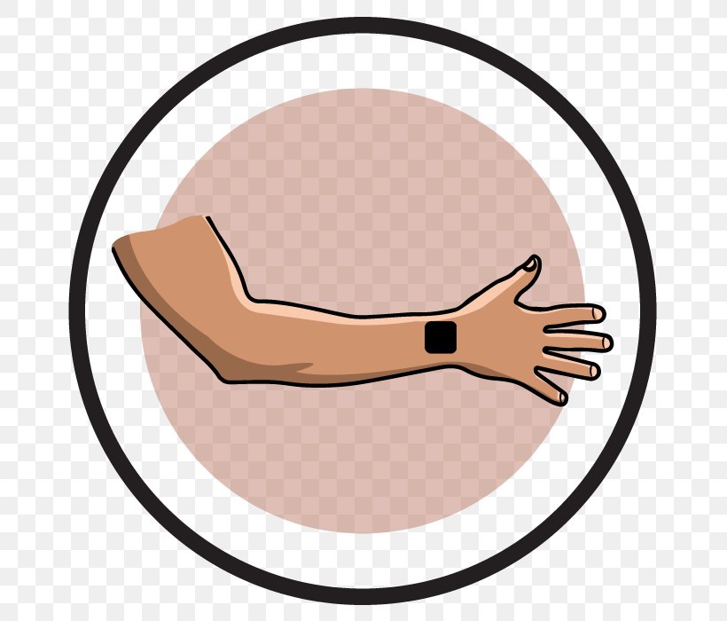 Transcutaneous Electrical Nerve Stimulation Thumb Carpal Tunnel Syndrome Therapy Wrist, PNG, 698x700px, Thumb, Arm, Carpal Bones, Carpal Tunnel, Carpal Tunnel Syndrome Download Free