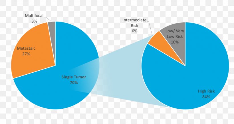 Gastrointestinal Stromal Tumor Chronic Myelogenous Leukemia Cancer Chart February, PNG, 1080x576px, 2017, Gastrointestinal Stromal Tumor, Bar Chart, Blue, Brand Download Free