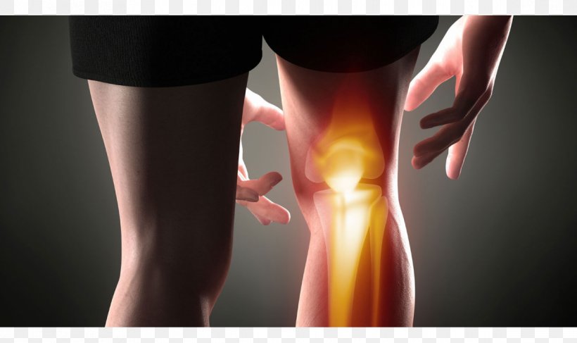 Knee Pain Knee Arthritis Pain Management Osteoarthritis, PNG, 1170x696px, Watercolor, Cartoon, Flower, Frame, Heart Download Free