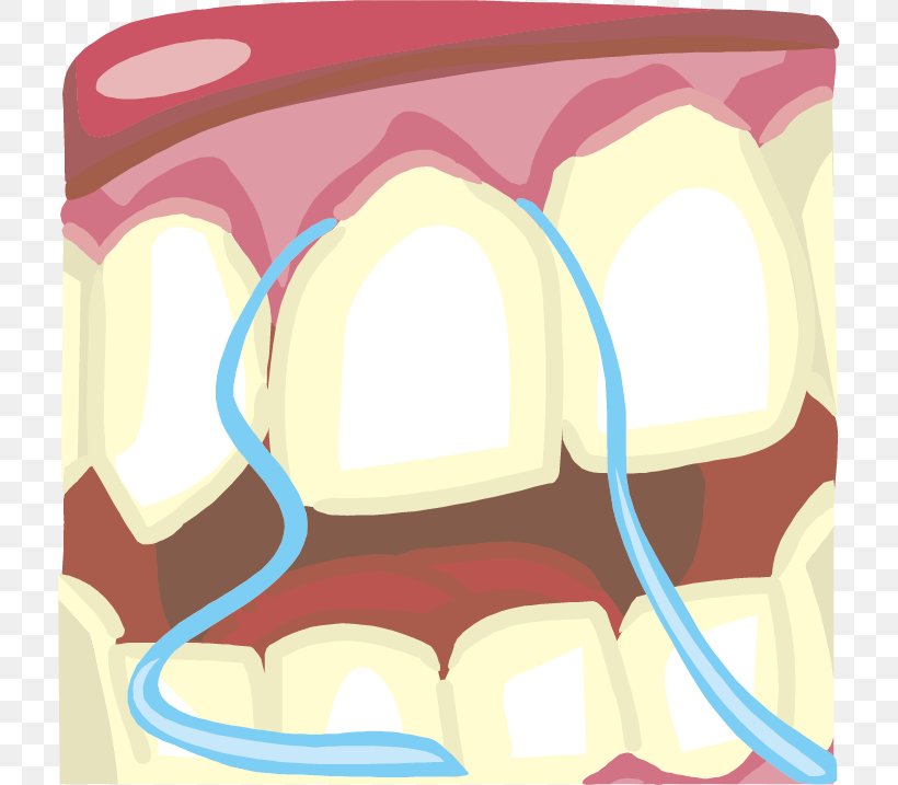 Tooth Pathology Dental Floss Tooth Brushing Clip Art, PNG, 714x717px, Watercolor, Cartoon, Flower, Frame, Heart Download Free