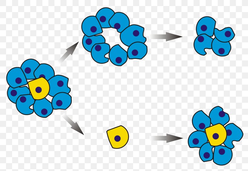 Cancer Stem Cell Neoplasm, PNG, 800x566px, Cancer Stem Cell, Acute Lymphoblastic Leukemia, Body Jewelry, Brain Tumor, Breast Cancer Download Free