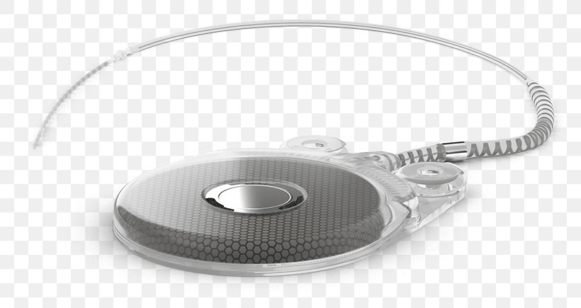 Cochlear Implant Hearing Oticon, PNG, 817x435px, Cochlear Implant, Bone Conduction, Cochlea, Ear, Electronics Accessory Download Free