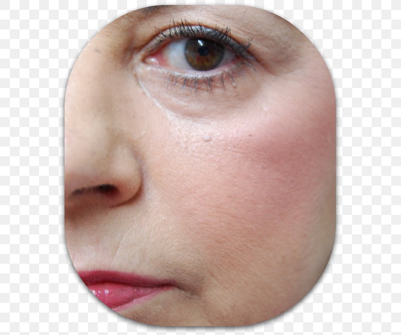 Skin Lip Forehead Eyelash Extensions Woman, PNG, 583x686px, Skin, Cheek, Chin, Close Up, Eye Download Free