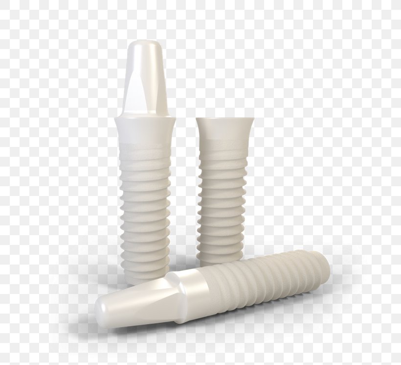 Dental Implant Dentist Ceramic Tooth, PNG, 720x745px, Dental Implant, Ceramic, Dental Surgery, Dentist, Implant Download Free