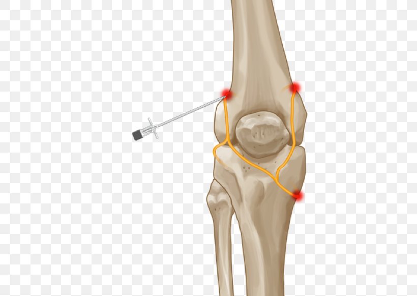 Knee Pain Thumb Joint Hip, PNG, 619x582px, Knee, Ache, Arm, Bone, Descending Genicular Artery Download Free