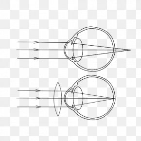 Eye - Far-sightedness Eye Near-sightedness Contact Lenses Astigmatism PNG