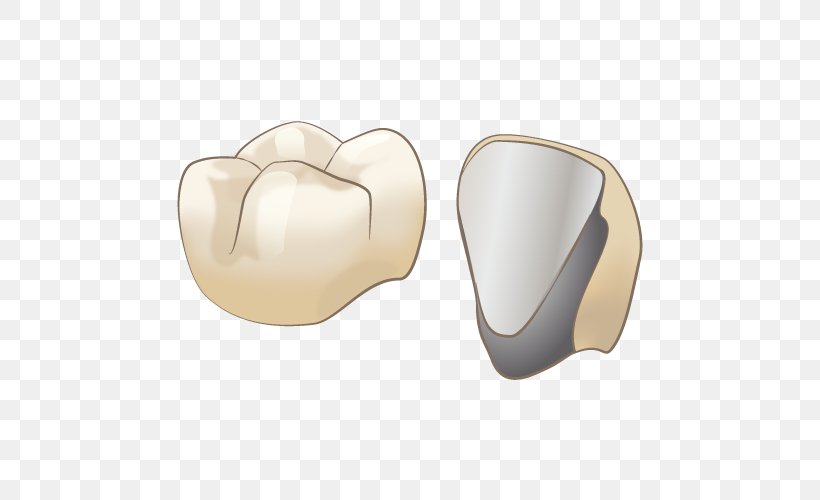 審美歯科 Dentist オールセラミック Therapy, PNG, 500x500px, Dentist, Bruxism, Therapy, Tooth, Tooth Decay Download Free