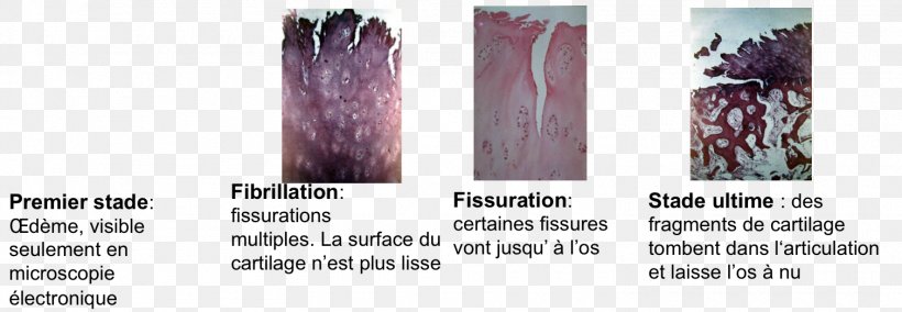 Hair Coloring Cartilage Joint Translation, PNG, 1510x524px, Hair Coloring, Beauty, Brush, Cartilage, Hair Download Free