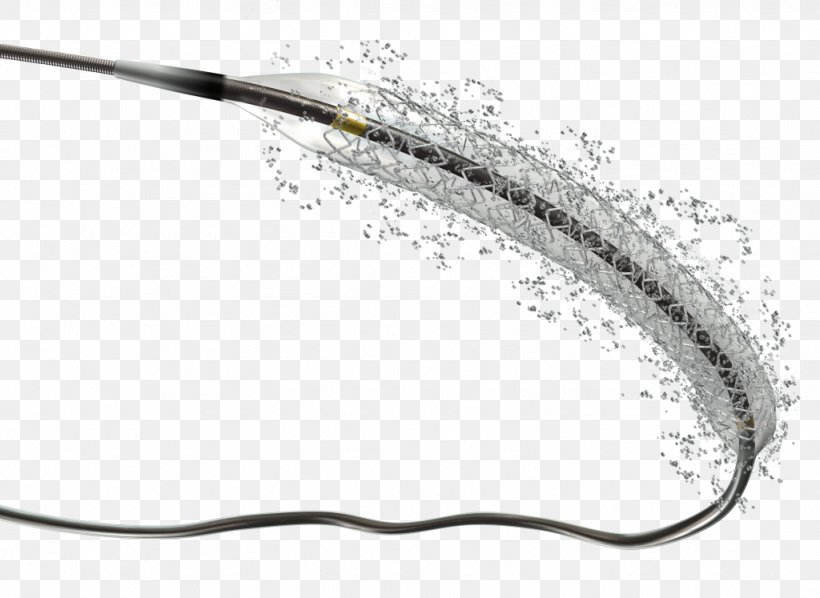 Drug-eluting Stent Stenting Coronary Stent Sirolimus Bioresorbable Stent, PNG, 1024x747px, Drugeluting Stent, Angioplasty, Balloon Catheter, Biodegradable Polymer, Bioresorbable Stent Download Free