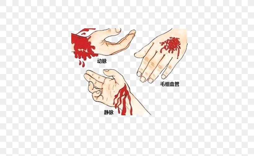 Emergency Bleeding Control First Aid Medical Sign Wound, PNG, 618x506px, Watercolor, Cartoon, Flower, Frame, Heart Download Free