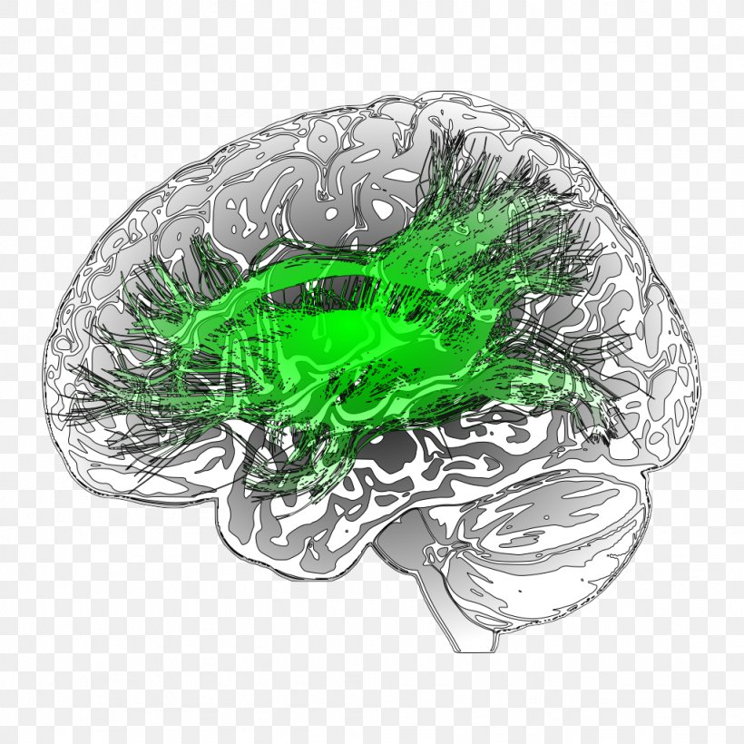 Leaf Medical Imaging Voxel Image Diagnostic Neuroradiology, PNG, 1024x1024px, Leaf, Flower, Green, Magnetic Resonance Imaging, Medical Imaging Download Free