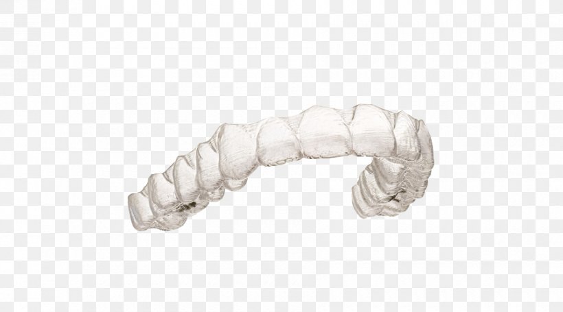 Clear Aligners Retainer Orthodontics Dental Braces Tooth, PNG, 900x500px, Clear Aligners, Dental Braces, Dental Laboratory, Dentist, Dentistry Download Free