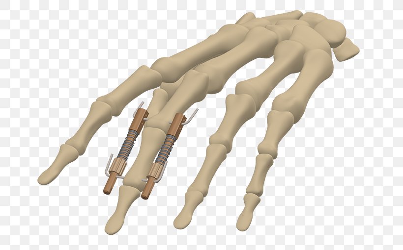 Finger, PNG, 702x510px, Finger, Arm, Hand, Human Leg, Joint Download Free