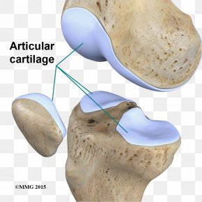 Articular Cartilage Damage Joint Articular Cartilage Repair CartÃ­lago Articular PNG